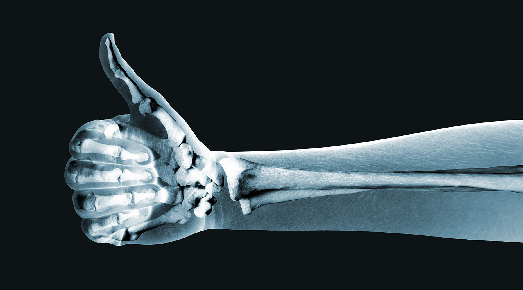 An x-ray is a common imaging test that has been used for decades and is one of the safest medical procedures available. It is a quick, painless test that produces images of the body’s internal structures.There is no special preparation needed for a regular diagnostic x-ray. An x-ray technician will give instructions on how you