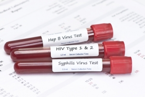 The Centers for Disease Control (CDC) has recently reported that STDs are on the rise for the first time since 2006. They have seen rises in three sexually transmitted diseases: chlamydia, gonorrhea,and syphilis.The biggest hike was in syphilis, which was up 15% since 2013.Costing the U.S. $16 billion annually, young people between the ages of