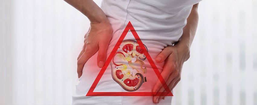 What Causes Kidney Stones?