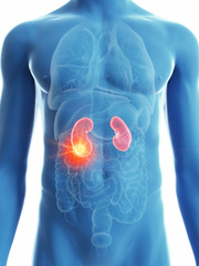 Exploring Kidney Health, Tips and Disease Prevention;  March is Kidney Disease Awareness Month