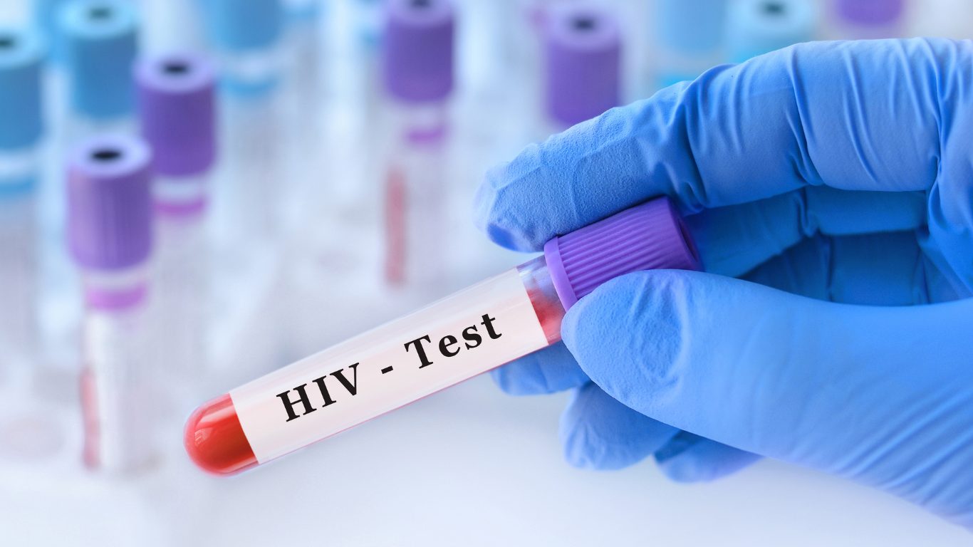 How Do I Know If I Have HIV?