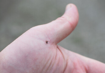 Tick removal at AFC Urgent Care Danbury Main St.