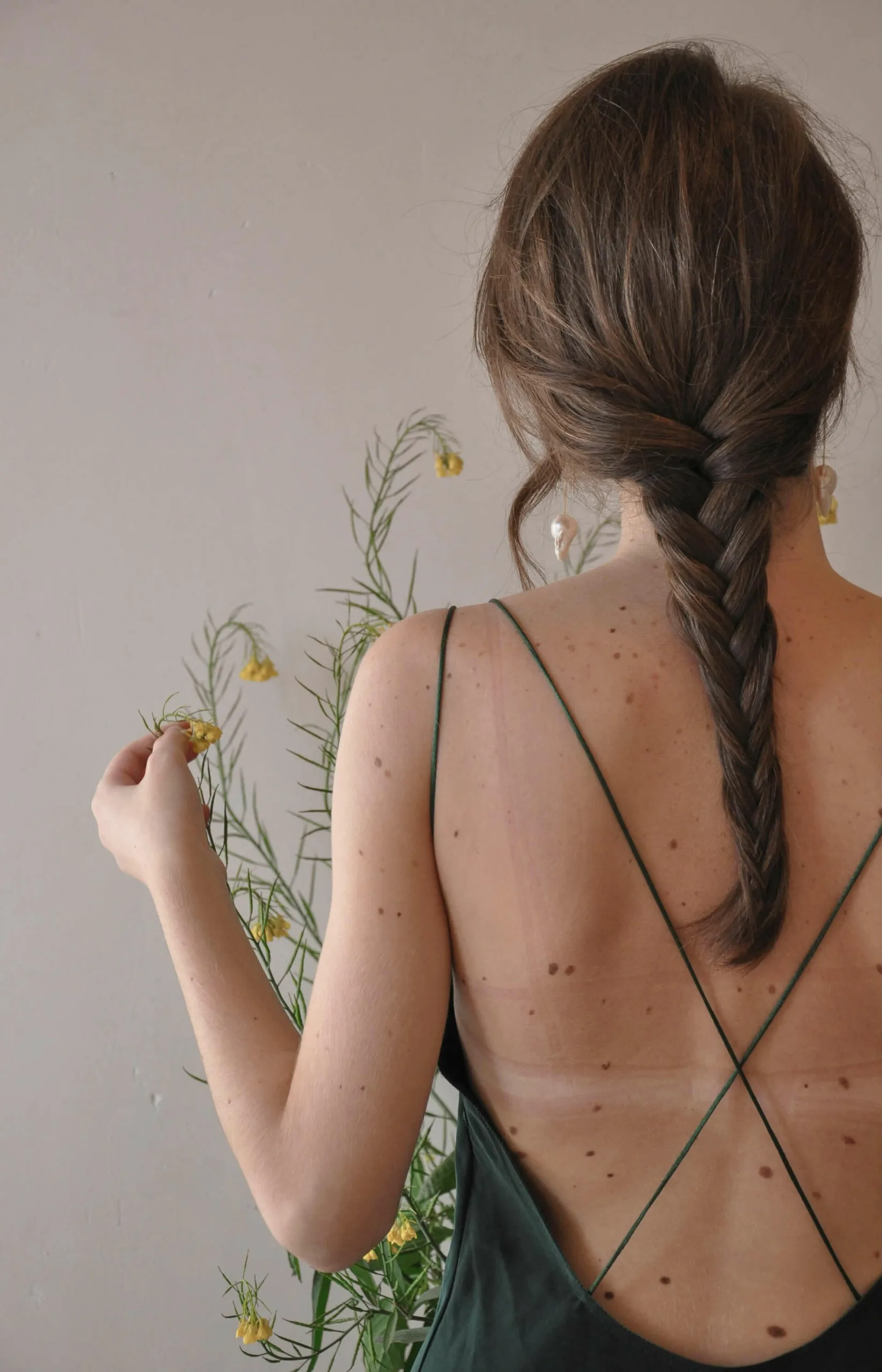 Woman with a braided hairstyle in a backless dress, holding a small flower and standing near greenery, looking as serene as a patient at a medical center.