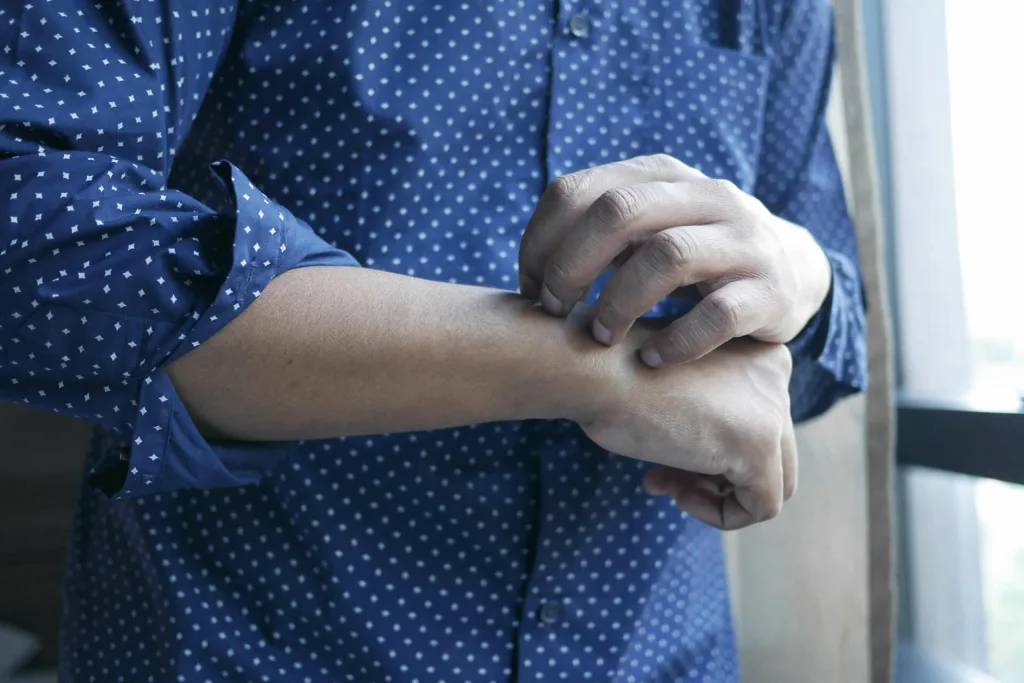 A person in a blue, polka-dotted shirt scratches their forearm near a window with sunlight coming through, contemplating whether they should visit the medical center for an urgent care appointment.