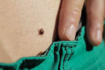 Deer Ticks and Lyme Disease: How To Avoid Getting Bitten and What to Do If You Are